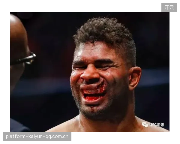 UFC重拳直接打掉牙齿,解说吓到语调破音! UFC重拳直接打掉牙齿,解说吓到语调破音!